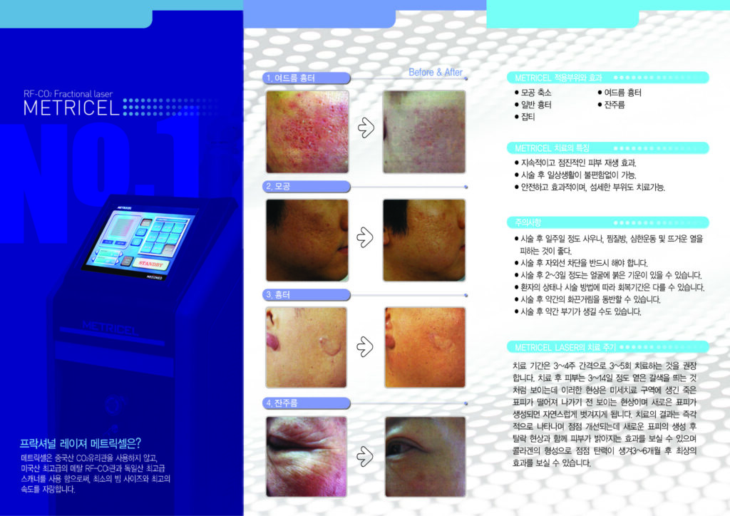 레이저치료기 번역_2